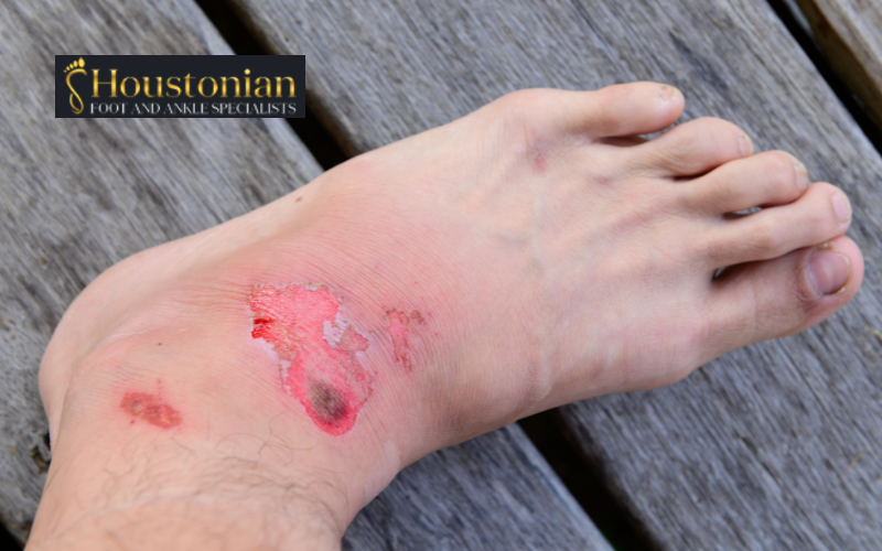 Wound Care Specialist in Houston | Houstonian Foot & Ankle